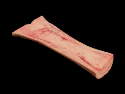 Kości rurkowe / szpikowe